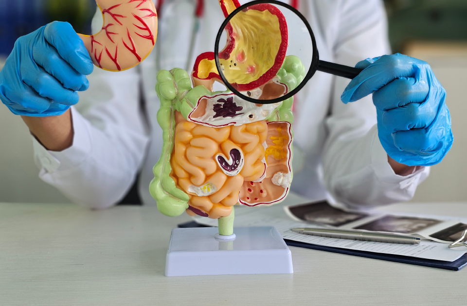 Doctor demonstrating a colorectal anatomy model to explain colorectal cancer and surgical treatment options