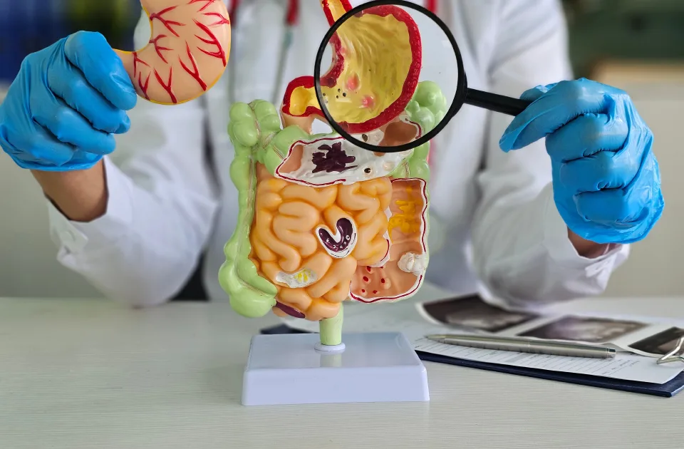 Colorectal Cancer Surgery: How the Right Treatment Is Chosen