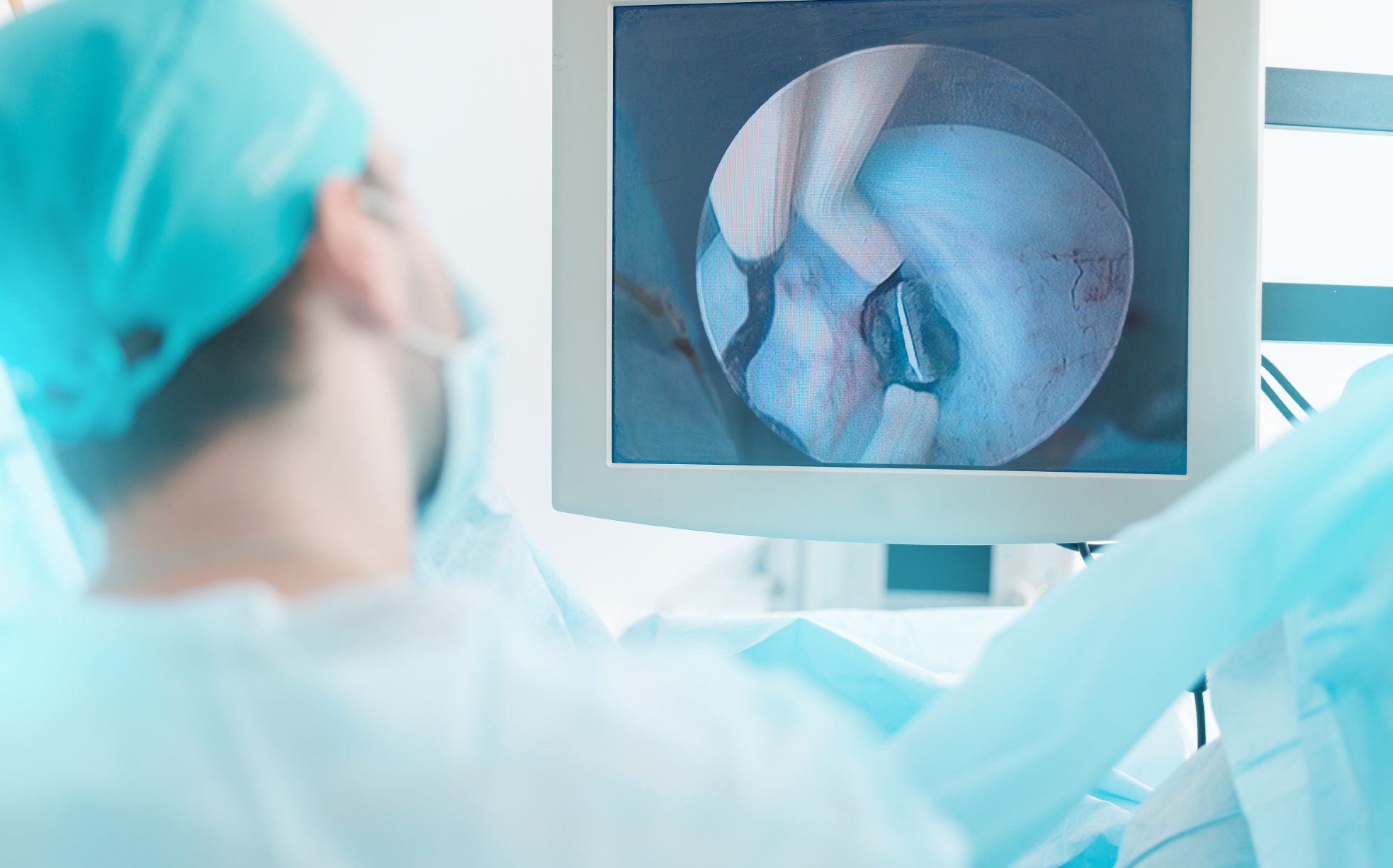 Colonoscopy doctor examining endoscopic image on monitor during procedure to assess and remove colorectal polyps safely
