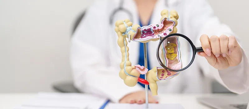 A colorectal specialist examining an anatomical diagram