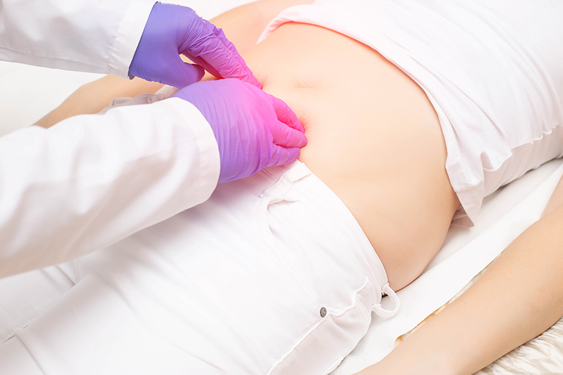 A woman receiving treatment for her hernia