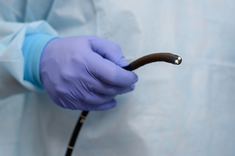 What Happens During a Colonoscopy and How Are Polyps Removed?