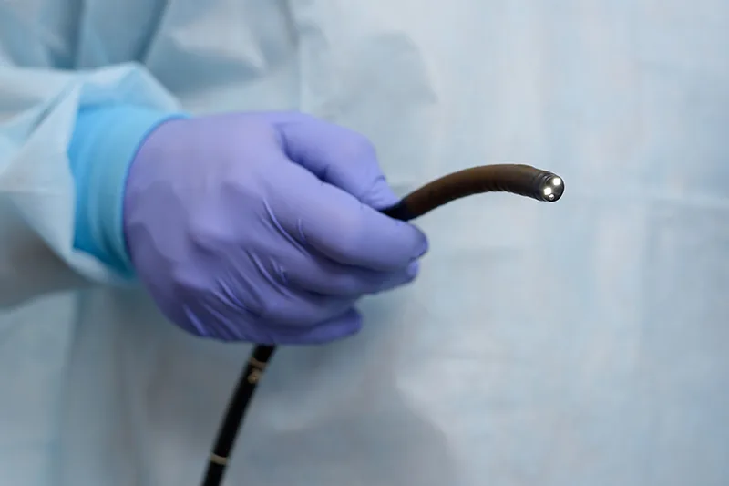 What Happens During a Colonoscopy and How Are Polyps Removed?