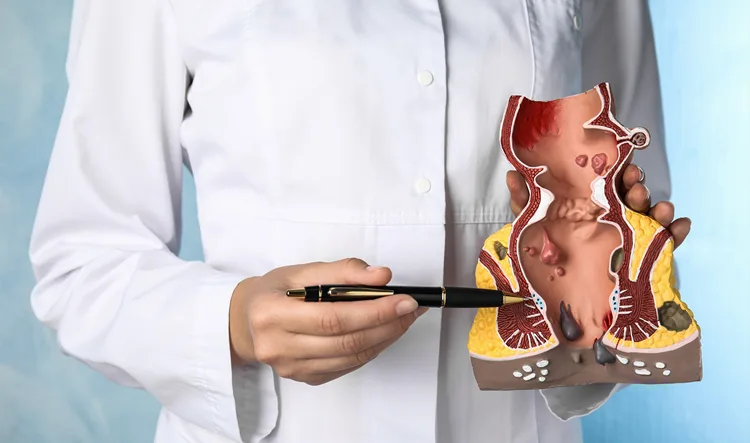 A doctor pointing at a colon diagram with a pen during a medical consultation