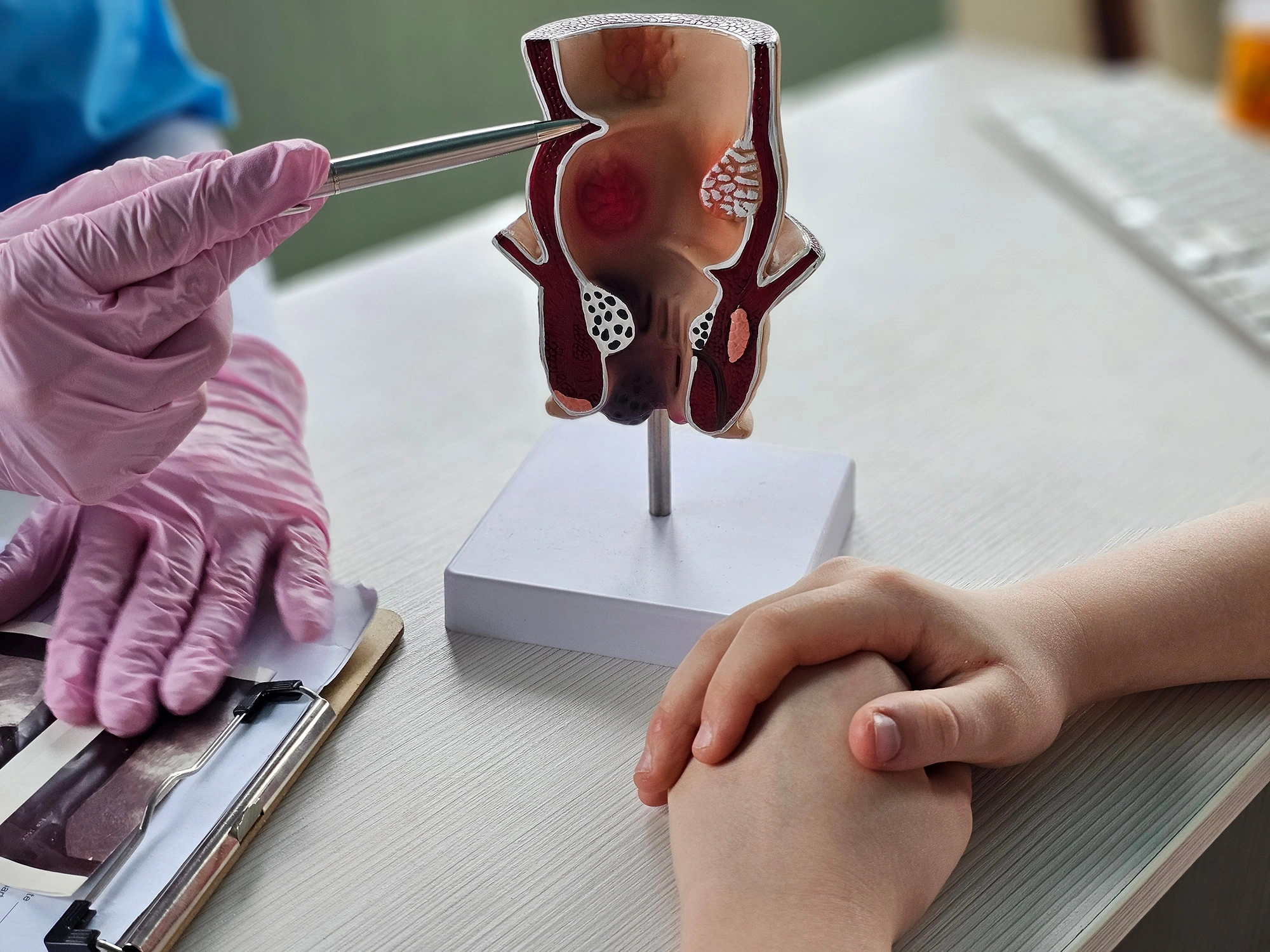 How a Colonoscopy Helps Protect Your Health